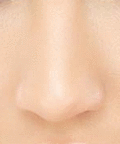 Nasen OP, Nasenoperation, Nasenkorrektur, Nasenverschönerung